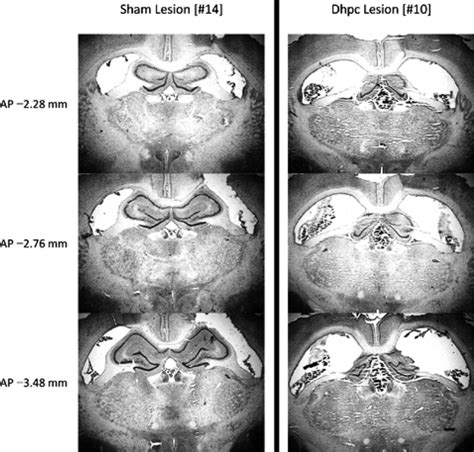 Photomicrographs Of Cresyl Violet Stained Coronal Sections Top To