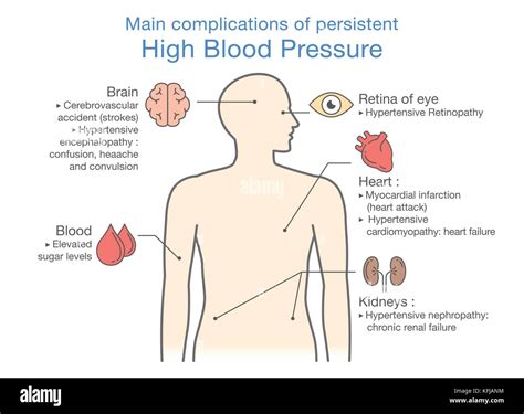 hypertension   effects