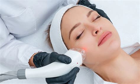 What Is An Intense Pulsed Light Ipl Photofacial