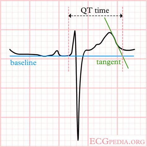 File LastigeQT2 Png ECGpedia