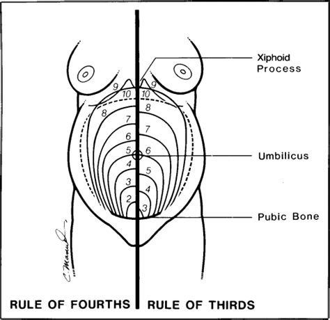 Measurement Of Fundal Height Journal Of Obstetric Gynecologic