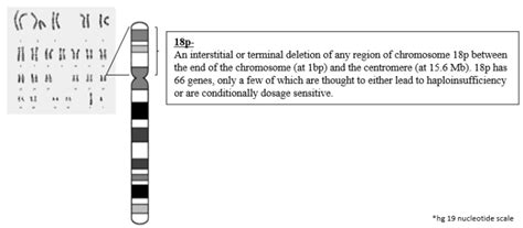 What is 18p: A Sixty-Second Summary - Chromosome 18