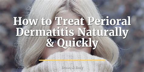 How to Treat Perioral Dermatitis Naturally & Quickly