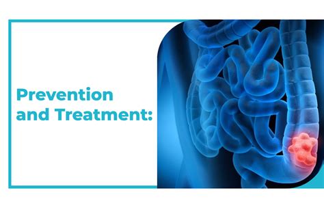 Colon Cancer Symptoms Stages And Treatment