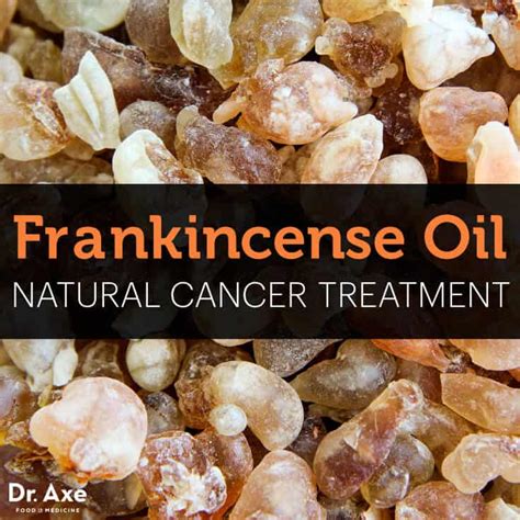 Frankincense Oil Cancer Natural Treatment - DrAxe.com