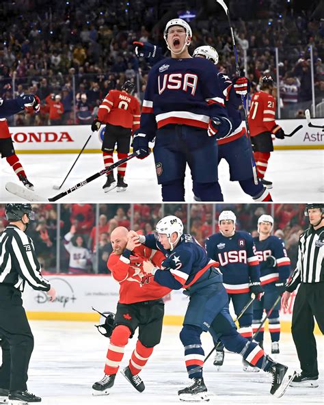 View all - Brady Tkachuk reveals his family's reaction to USA vs Canada