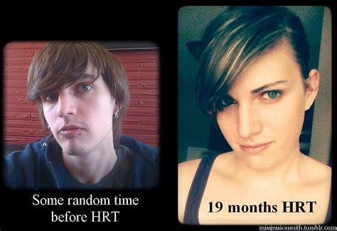 Mtf 19 Months Hrt Transtimelines