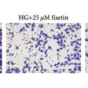 The Effect Of Fisetin On Hg Induced Migration Of Hrmecs A Transwell