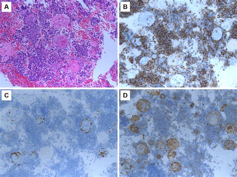 Figure3morphologic Features And Immunohistochemical Staining Of A Download Scientific Diagram