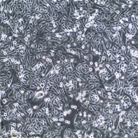 Primary Human Male Mammary Epithelial Cells