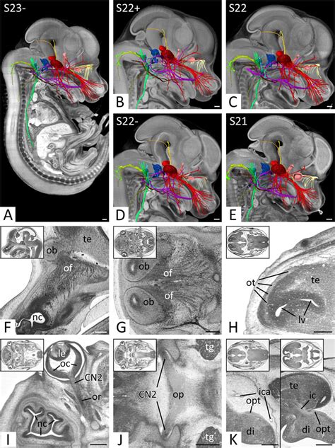 Frontiers Detailed Characterizations Of Cranial Nerve Anatomy In E14