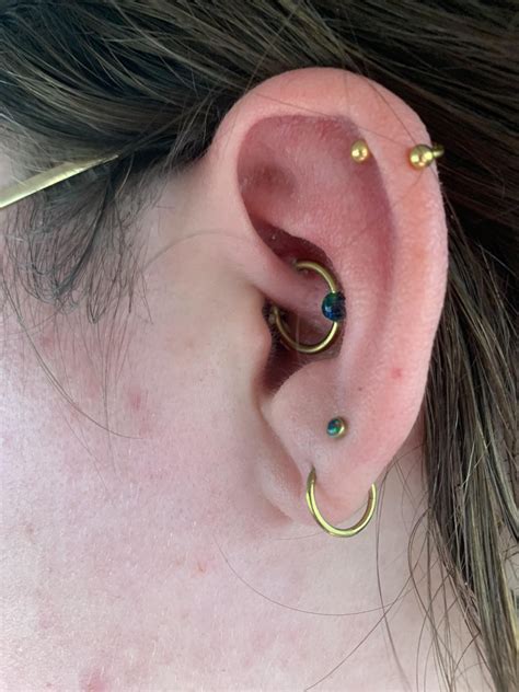 Daith Piercing Bumps Get Better Hang In There Heres My Healing Over