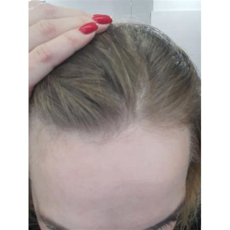 Onlybio Hair In Balance Wcierka Booster Intensywnie Pobudzaj Cy