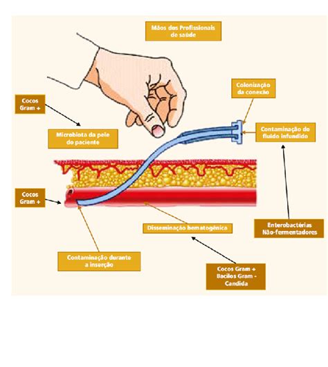 Prevenção de Infecção Primária da Corrente Sanguínea Associada a