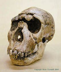 Homo Erectus Ou Homo Ergaster KNM WT 15000