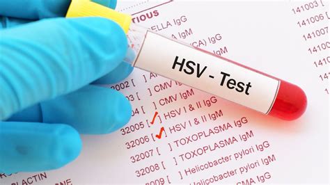 Herpes bucal Cauze și tratament eficient LLL Dental