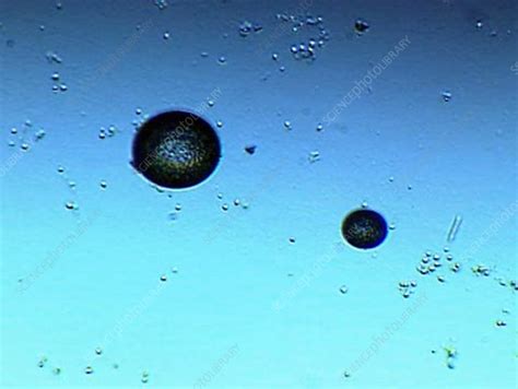 Didinium Nasutum Protozoa Cysts Stock Video Clip K0021730