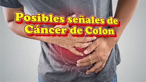 Posibles señales de Cáncer de Colon YouTube