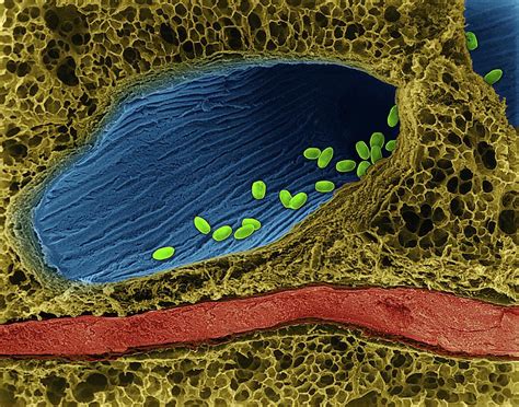 Bacillus Anthracis Spores In Lung Photograph By Dennis Kunkel