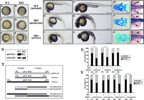 Drpax1b Knockdown In Zebrafish Embryos A L Drpax1b Knockdown Causes