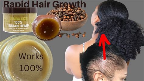 Mix Indian Hemp And Cloves To Stop Hair Loss Alopecia And Baldness To