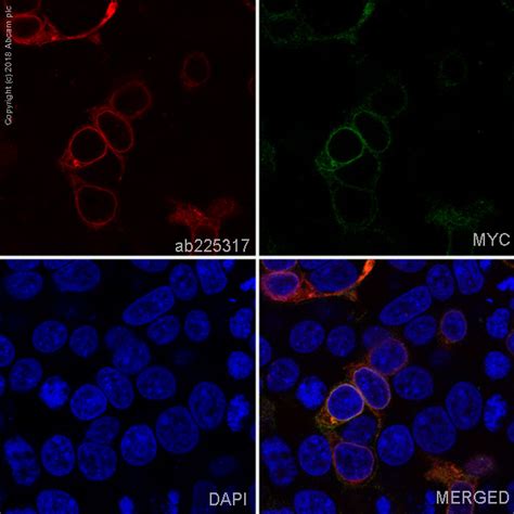 Alexa Fluor 647 Anti Prolactin PRL Antibody EPR19386 Ab225317 Abcam