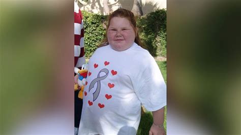 Texas Girl 12 Who Is Always Hungry To Get Gastric Bypass Abc News