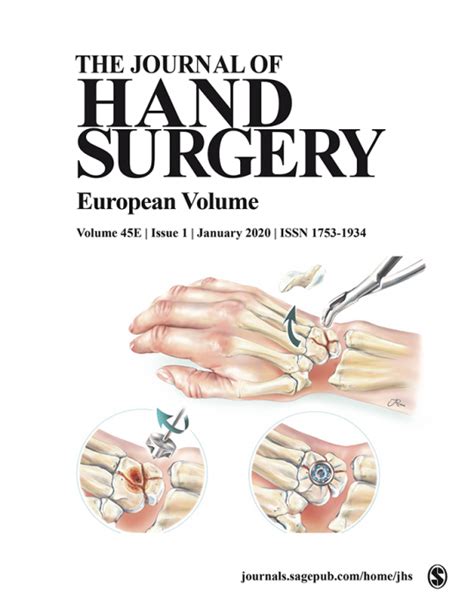 Buy Journal Of Hand Surgery European Volume Subscription Sage