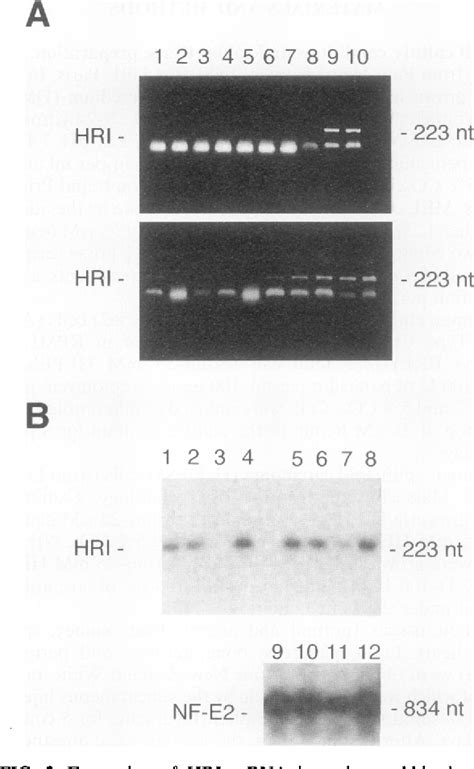 Figure From Erythroid Expression Of The Heme Regulated Eif A Kinase