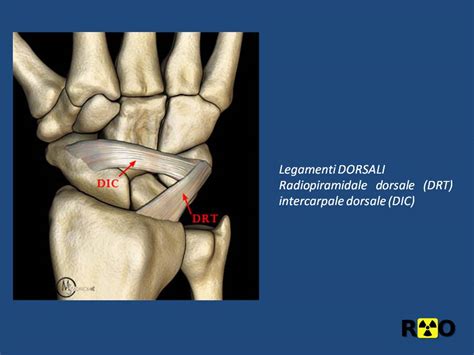 Instabilità carpale Radiologia Ortopedica