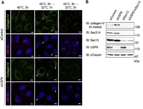 Figure From Ubiquitin Specific Protease Deubiquitinates Sec A And