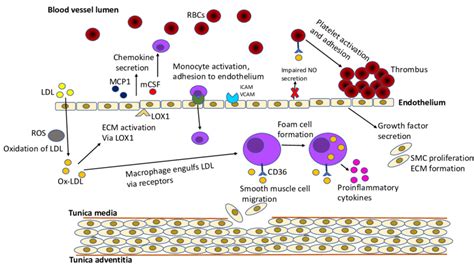 Summary Of The Role Of Ox Ldl In Atherosclerosis Progression Ox Ldl