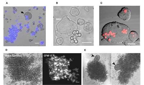 Figure 1 From Cellular Events Of Multinucleated Giant Cells Formation During The Encystation Of