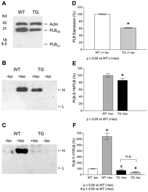 Phospholamban PLB Expression A And D And Phosphorylation At Ser 16