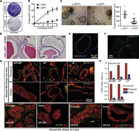 Histone 2b Gfp Label Retaining Prostate Luminal Cells Possess