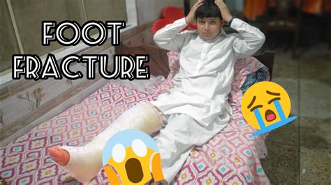 Pair Fracture Ho Gaya YouTube