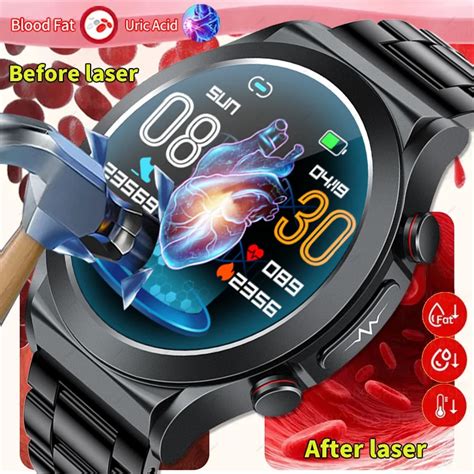 Reloj Inteligente Ecg Ppg Para Hombre Pulsera Con Bluetooth Monitor De