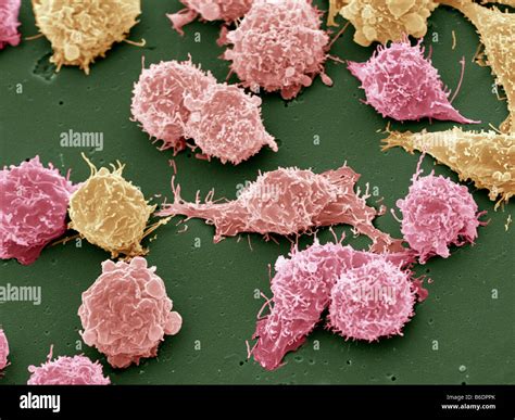 Cultured Cancer Cells Coloured Scanning Electronmicrograph Sem Stock