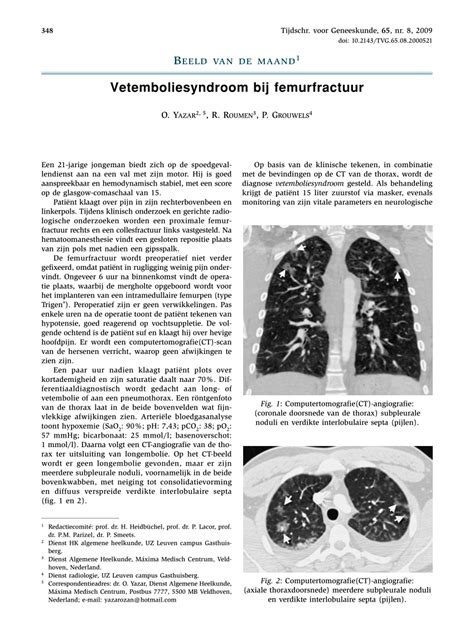 Pdf Fat Embolism Syndrome After Long Bone Fracture