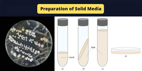 Preparation Of Solid Media Agar Deep Tubes Agar Slants Plates