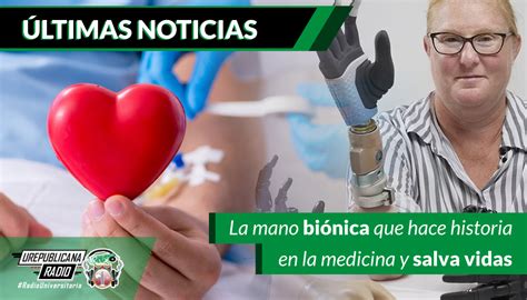 La Mano Bi Nica Que Hace Historia En La Medicina Y Salva Vidas