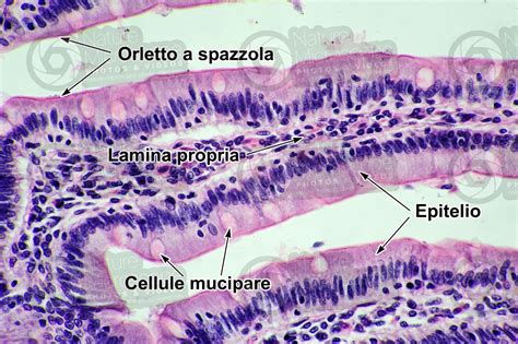 Uomo Intestino Tenue Sezione Trasversale 500X Intestino Tenue