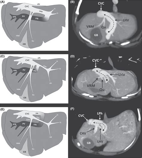 What Is A Liver Shunt In Dogs