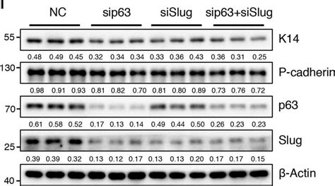 Mouse P Cadherin Antibody AF761 R D Systems