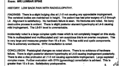 MRI result : r/Ovariancancer