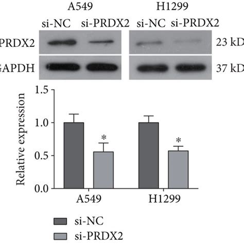 Knockdown Of Prdx Inhibits Activation Of The Akt Mtor Signaling