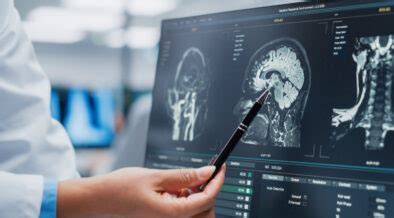 Neurocientista: conheça a profissão e o mercado - Trendings