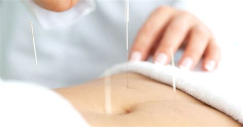 Acupuncture for Weight Loss | Southlake Natural Family Wellness | Texas