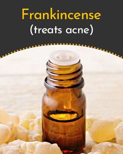 Essential Oils For Scars A Smarter Option To Choose For Healing Scars