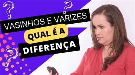 Desvendando Mitos A Conexão entre Vasinhos e Varizes YouTube